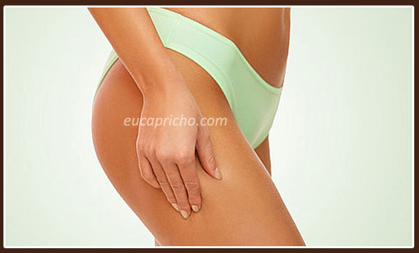 Eu Capricho na Estética Estrias imagem estrias7 Eu Capricho na Estética Estrias